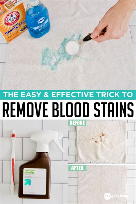 what takes out blood stains